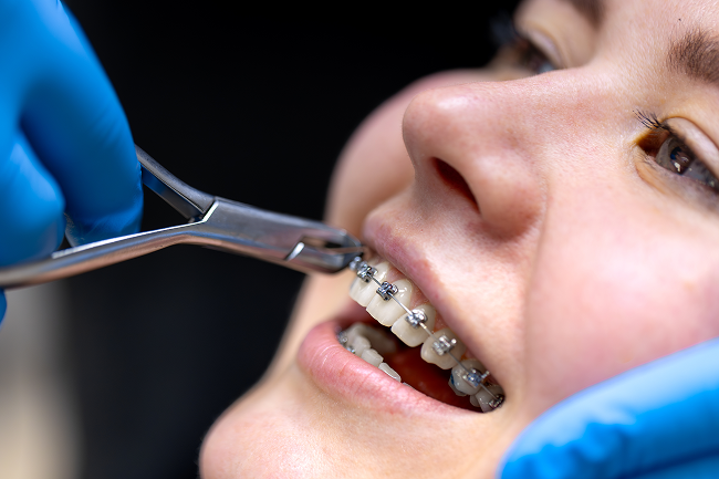 orthodontics_image